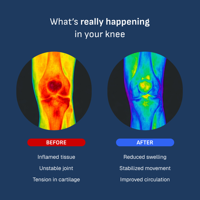 My Sports House™ Knee Brace